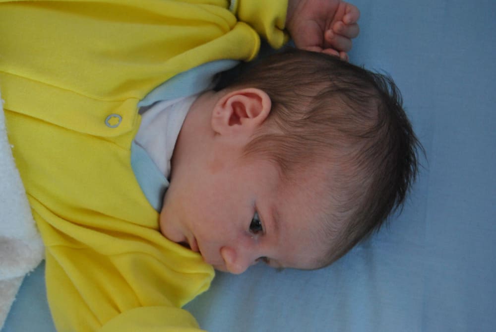 التهاب الاذن الوسطى عند الرضع