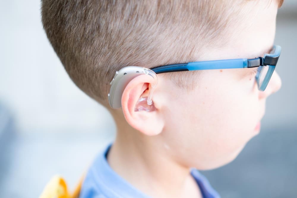 ما بعد زراعة القوقعة