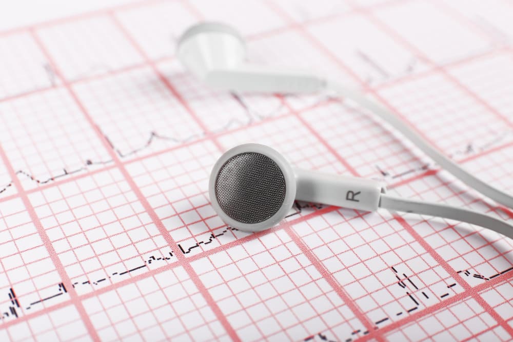 مخطط السمع الطبيعي